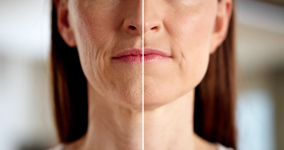 Inflammaging - Major factor for Skin Aging | Amranthe Skincare