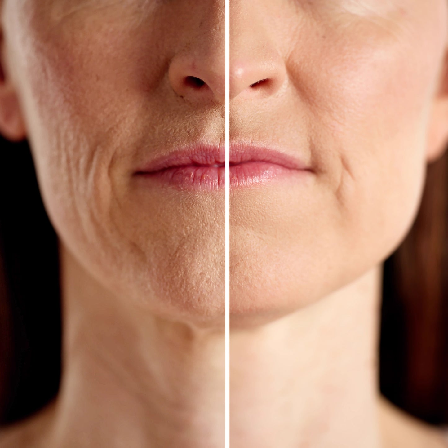 Amranthe AHA Peeling Concentrate