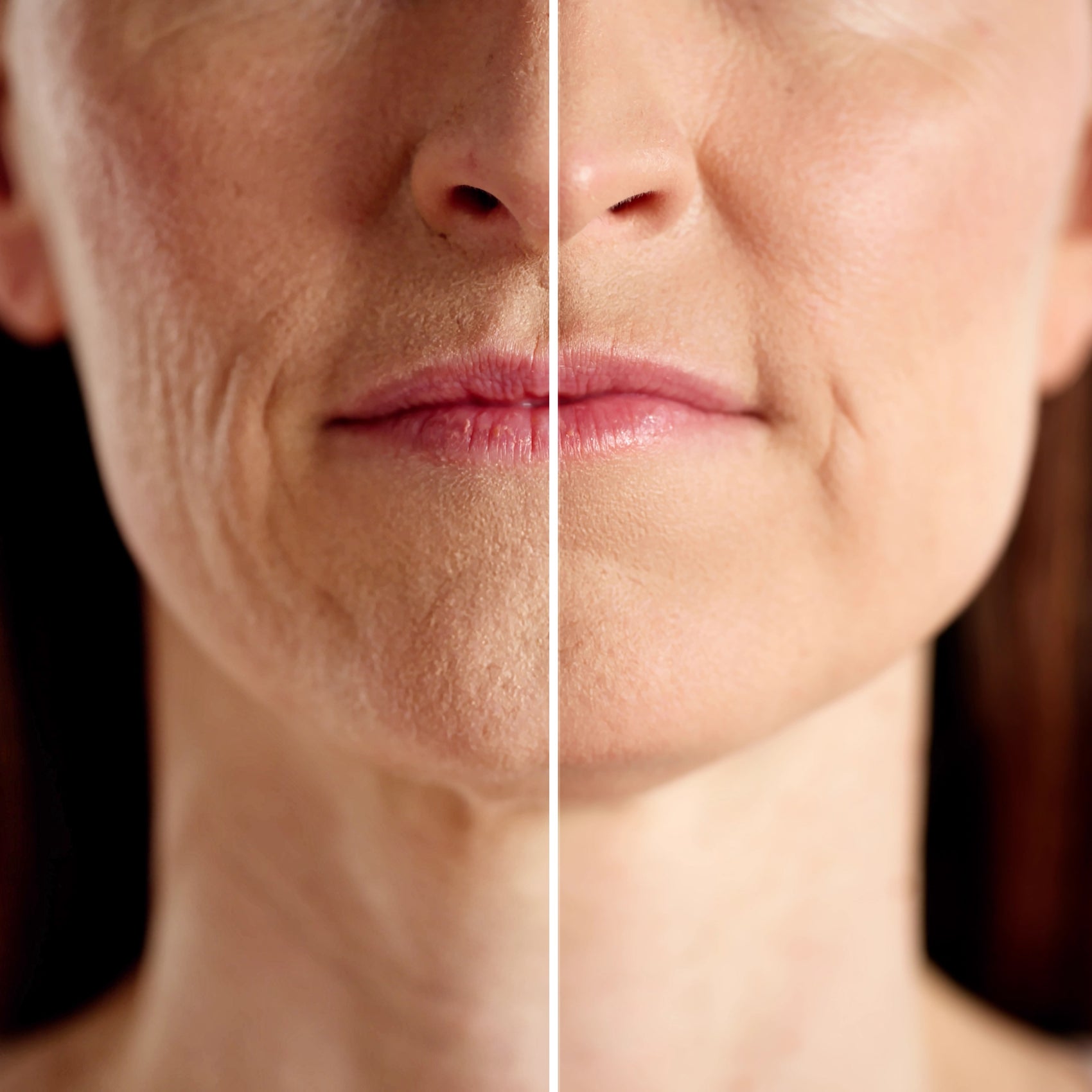 Amranthe AHA Peeling Concentrate