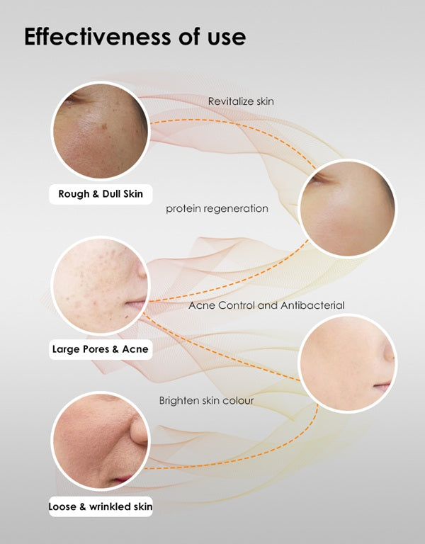 Amranthe Red Light Therapy Face Mask